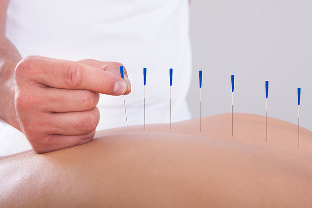 8 MYTHS YOU BELIEVE ABOUT ACUPUNCTURE